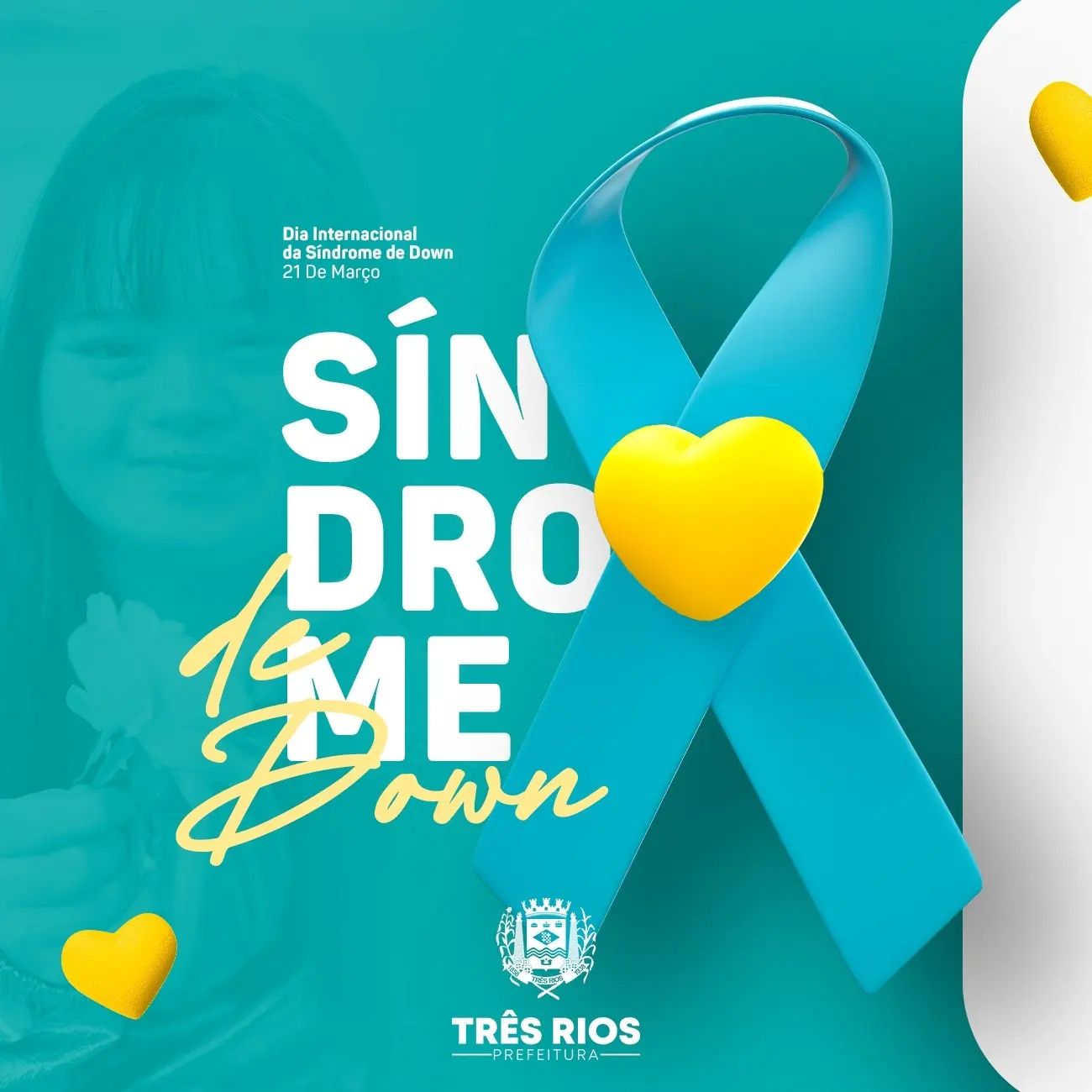 Dia Mundial da Síndrome de Down: Prefeitura oferece suporte a pessoas com a síndrome