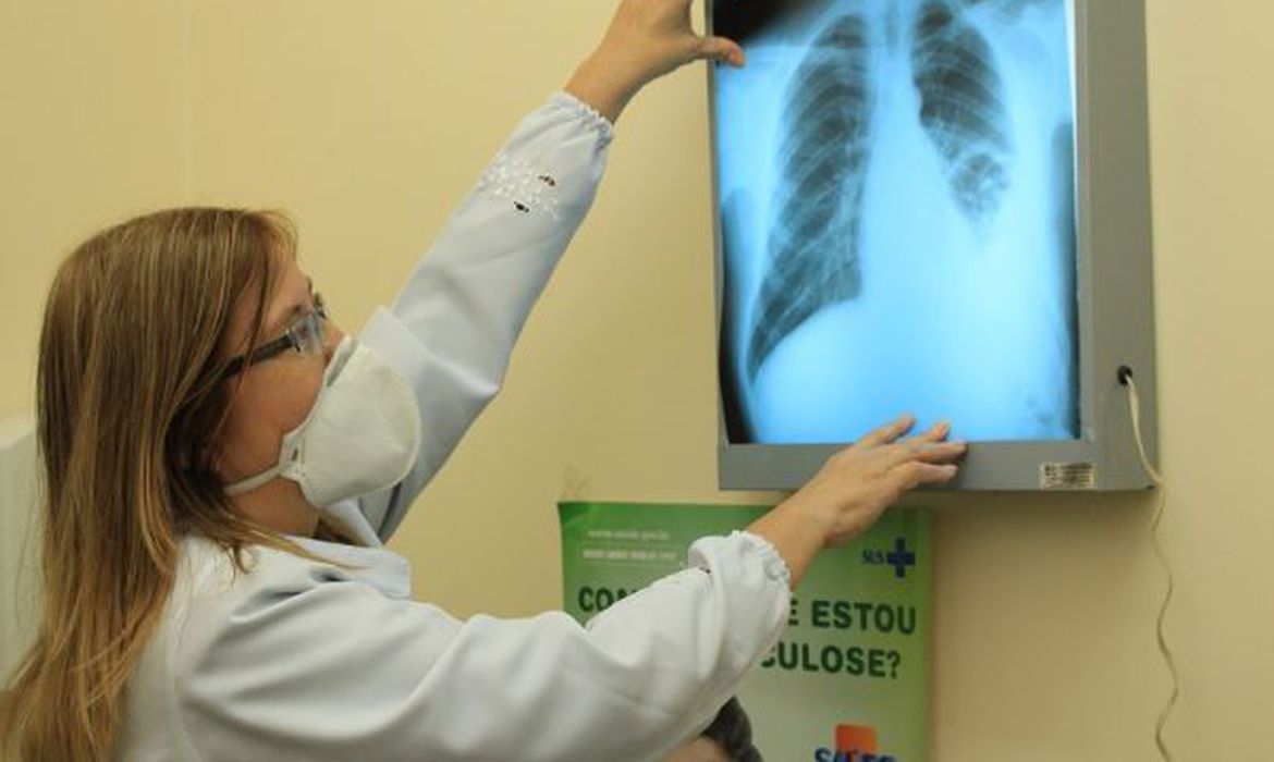 Tuberculose: sem abandono do tratamento, doença tem cura; Três Rios oferece suporte